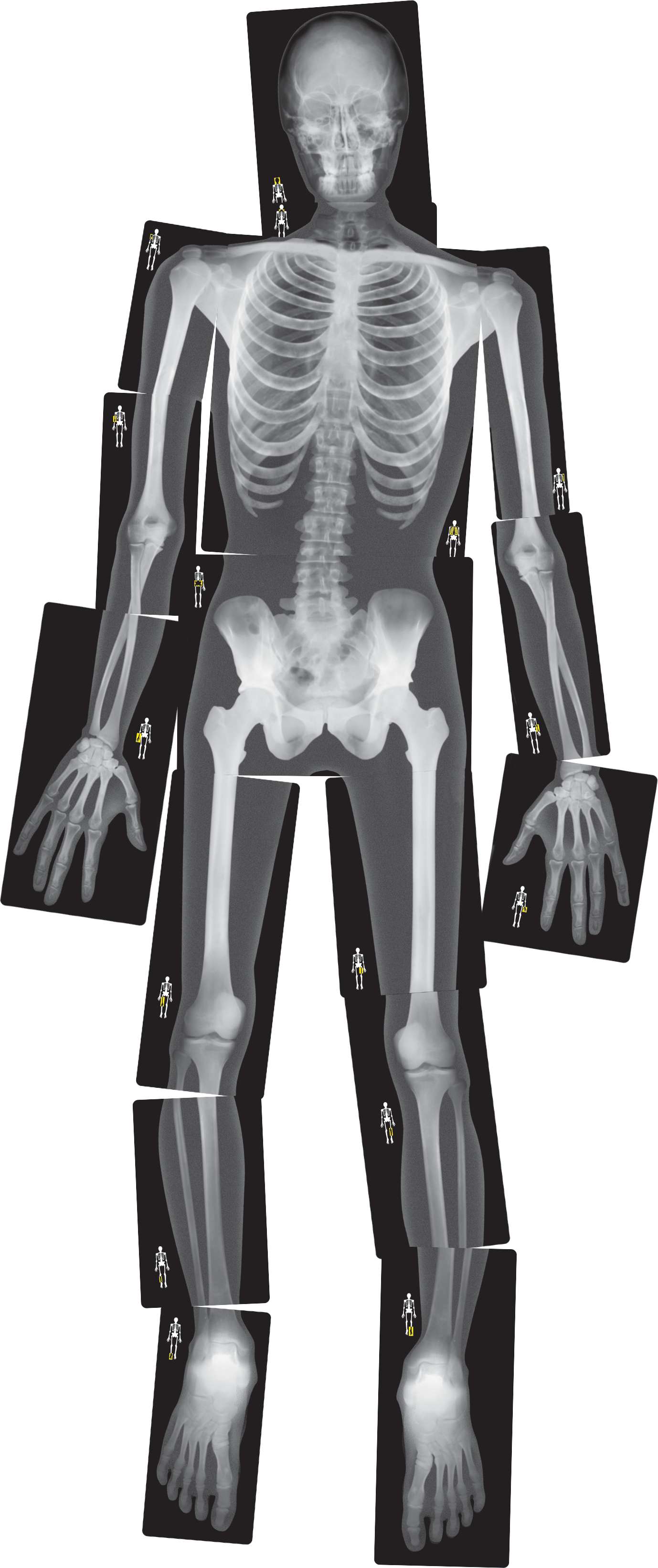 Röntgenbilder Mensch Modelle Biologie Demonstrationsgeräte And Anschauungsmaterialien Schule